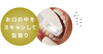 お口の中をスキャンして型取り