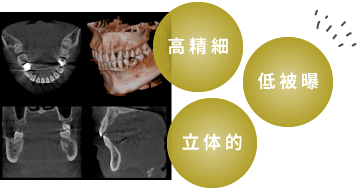 高精細 低被曝 立体的